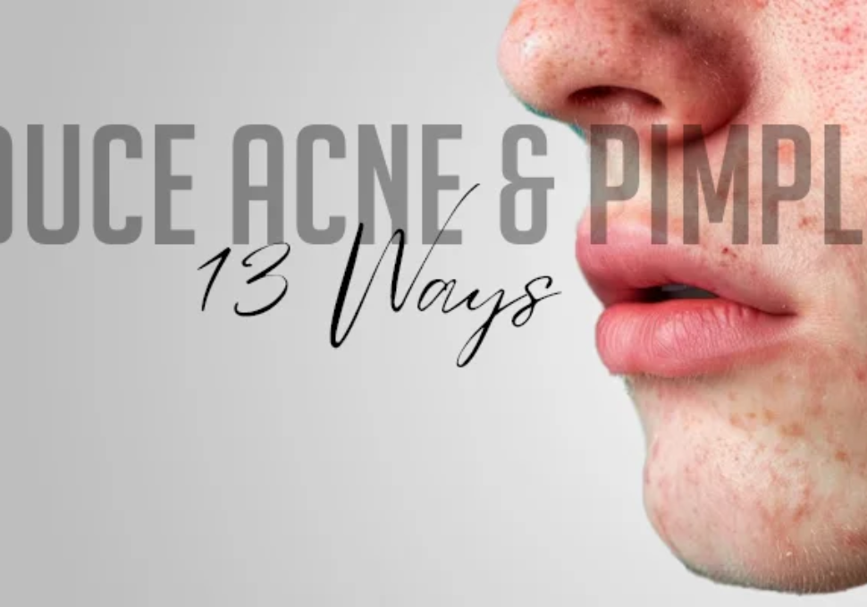 13-Ways-to-reduce-Acne-&-Pimple